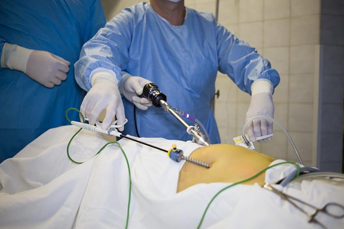 Best Laparoscopic Surgeon in Rewa